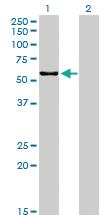 Anti-CPNE1 Mouse Monoclonal Antibody [clone: 8B8]