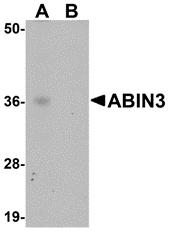 Western blot analysis of ABIN3 in human spleen tissue lysate with ABIN3 antibody at 1 &#956;g/mL in (A) the absence and (B) the presence of blocking peptide.