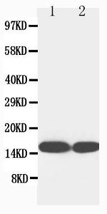 Anti-S-100 (beta-subunit) Mouse Monoclonal Antibody [clone: SA-12]