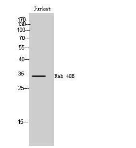 Western blot analysis of Jurkat cells using Anti-RAB40B Antibody