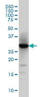 Anti-HNMT Mouse Monoclonal Antibody [clone: 3G12]