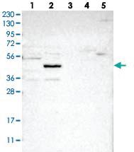 Anti-NSUN5 Rabbit Polyclonal Antibody