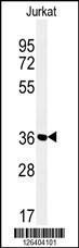 Anti-MFRN2 Rabbit Polyclonal Antibody (APC (Allophycocyanin))