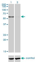 Anti-CPNE1 Mouse Monoclonal Antibody [clone: 8B8]