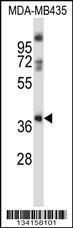 Anti-GPR15 Rabbit Polyclonal Antibody (PE (Phycoerythrin))