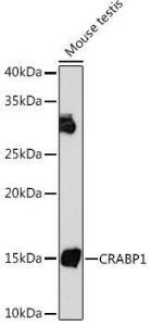 Western blot analysis of extracts of Mouse testis, using Anti-CRABP1 Antibody [ARC1991] (A308999) at 1:1,000 dilution The secondary antibody was Goat Anti-Rabbit IgG H&L Antibody (HRP) at 1:10,000 dilution Lysates/proteins were present at 25 µg per lane