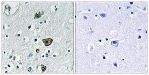 Immunohistochemical analysis of paraffin-embedded human brain using Anti-RAB40B Antibody 1:100 (4 °C overnight). The right hand panel represents a negative control, where the antibody was pre-incubated with the immunising peptide