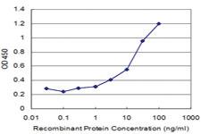 Anti-TMSB10 Mouse Monoclonal Antibody [clone: 2E3]