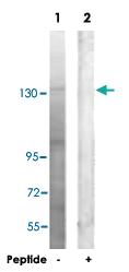 Anti-PLCG2 Rabbit Polyclonal Antibody