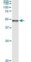 Anti-PUS1 Mouse Monoclonal Antibody [clone: 3A3]