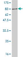 Anti-DLD Mouse Monoclonal Antibody [clone: 2D4]