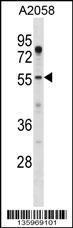 Anti-ASPSCR1 Rabbit Polyclonal Antibody (HRP (Horseradish Peroxidase))