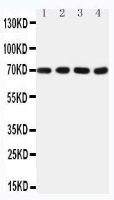 Anti-Tau Mouse Monoclonal Antibody [clone: TAU-93]