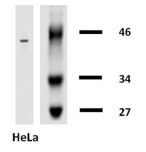 Western Blotting analysis of cytokeratin 18 in HeLa cells using Anti-Cytokeratin 18 Antibody (A86585)