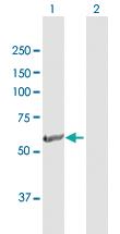 Anti-BBS4 Rabbit Polyclonal Antibody