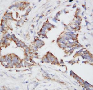 Anti-Osteopontin Rabbit Polyclonal Antibody