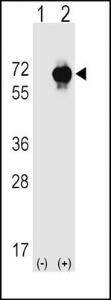 Anti-STK39 Rabbit Polyclonal Antibody (AP (Alkaline Phosphatase))