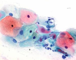 Merckoglas® for cytological screening