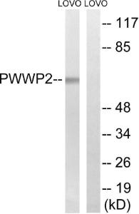 Anti-PWWP2B antibody