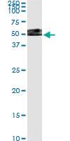 Anti-ERP44 Antibody Pair