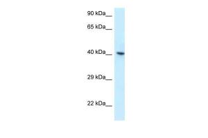 Anti-RBMX Rabbit Polyclonal Antibody