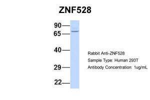 Anti-ZNF528 Rabbit Polyclonal Antibody