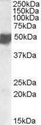 Anti-ASAM Antibody (A84595) staining (05 µg/ml) of Human Placenta lysate (RIPA buffer, 35 µg total protein per lane) Primary incubated for 1 hour Detected by western blot using chemiluminescence