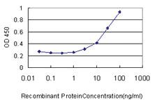 Anti-AP1S2 Mouse Monoclonal Antibody [clone: 3B9-G5]