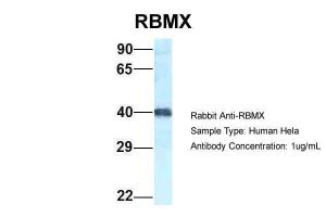 Anti-RBMX Rabbit Polyclonal Antibody