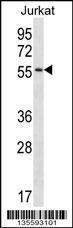 Anti-C1RL Rabbit Polyclonal Antibody (Biotin)