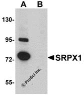 Western blot analysis of SRPX1 in SK-N-SH cell lysate with SRPX1 antibody at 0.25 &#956;g/mL in (A) the absence and (B) the presence of blocking peptide.