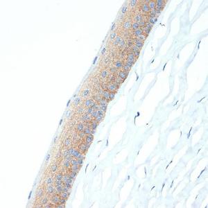 Immunohistochemistry analysis of paraffin-embedded rat cornea using Anti-CRABP1 Antibody [ARC1991] (A308999) at a dilution of 1:100 (40x lens) Perform microwave antigen retrieval with 10 mM Tris/EDTA buffer pH 90 before commencing with IHC staining protocol