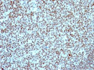 Immunohistochemical analysis of formalin-fixed, paraffin-embedded human tonsil using Anti-Nucleolin Antibody [NCL/902]