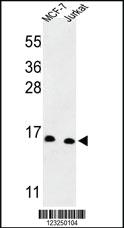 Anti-SNRPD3 Rabbit Polyclonal Antibody