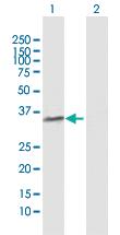 Anti-POLR3F Rabbit Polyclonal Antibody