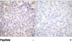 Anti-PLCG2 Rabbit Polyclonal Antibody