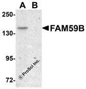 Western blot analysis of FAM59B in SK-N-SH cell lysate with FAM59B antibody at 1 &#956;g/mL in (A) the absence and (B) the presence of blocking peptide.