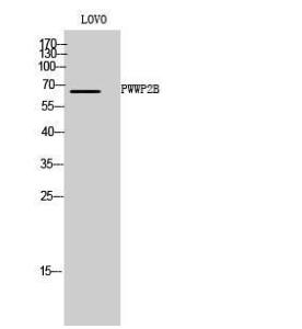 Anti-PWWP2B antibody