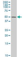 Anti-AP1M1 Mouse Polyclonal Antibody