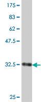 Anti-SLC35A2 Mouse Polyclonal Antibody