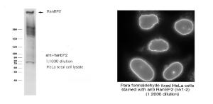 Anti-RanBP2 antibody