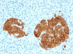 Anti-GAD65 antibody