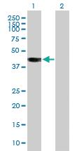 Anti-BCAT2 Mouse Polyclonal Antibody