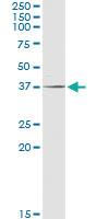 Anti-POLR3F Rabbit Polyclonal Antibody