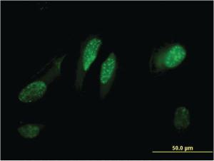 Anti-RGCC Mouse Monoclonal Antibody [clone: 3B9]