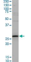 Anti-TNNT3 Mouse Monoclonal Antibody [clone: 1H4]