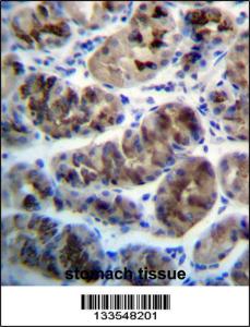 Anti-ZDHHC20 Rabbit Polyclonal Antibody