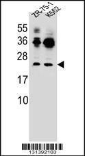 Anti-FRAT2 Rabbit Polyclonal Antibody