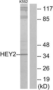 Western blot analysis of lysates from K562 cells using Anti-HEY2 Antibody. The right hand lane represents a negative control, where the antibody is blocked by the immunising peptide