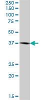 Anti-BCAT2 Mouse Polyclonal Antibody